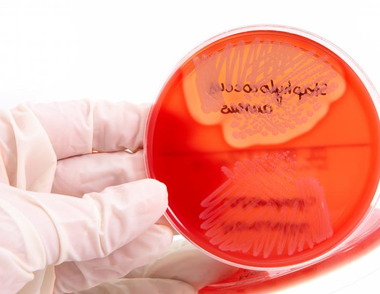 drug resistance horses, british equine veterinary association, multiple drug resistance equine levels